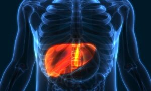 fatty-liver disease