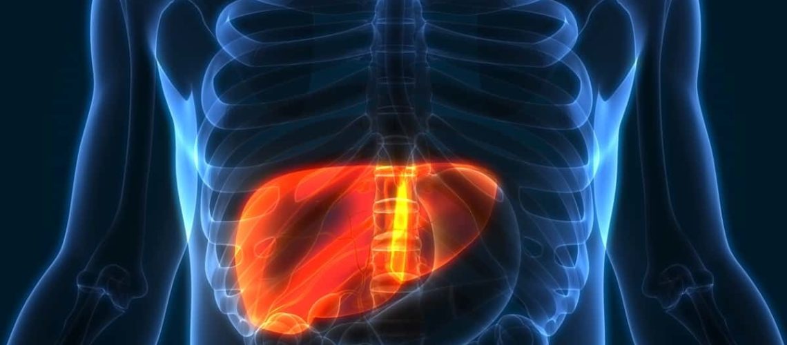 fatty-liver disease